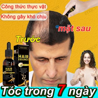 Cứu tóc mỏng kích mọc tóc nhật bản thuốc kích thích mọc tóc thuốc mọc tóc nhanh thuốc mọc tóc nhanh cho nam