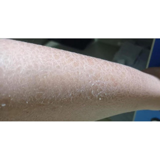Kem Dưỡng Ẩm  Chống Nẻ Vitamin E 200ml  thái lan ( HSD mới)