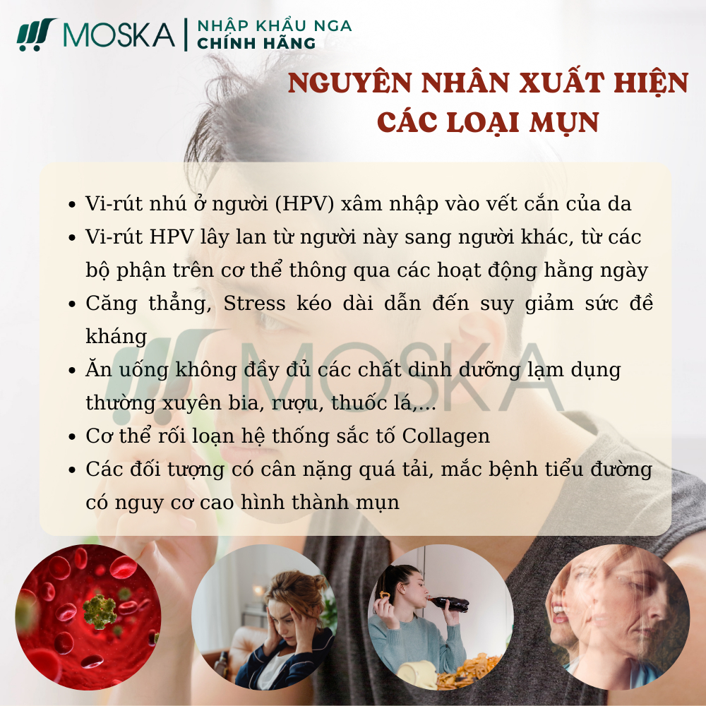 WART REMOVAL EELHOE MỸ 20GR - Kem Bôi Thảo Mộc Không Rát, Tẩy Mụn Thịt Quanh Mắt, Mụn Cóc, Mụn Ruồi, Mụn Gạo | MOSKA