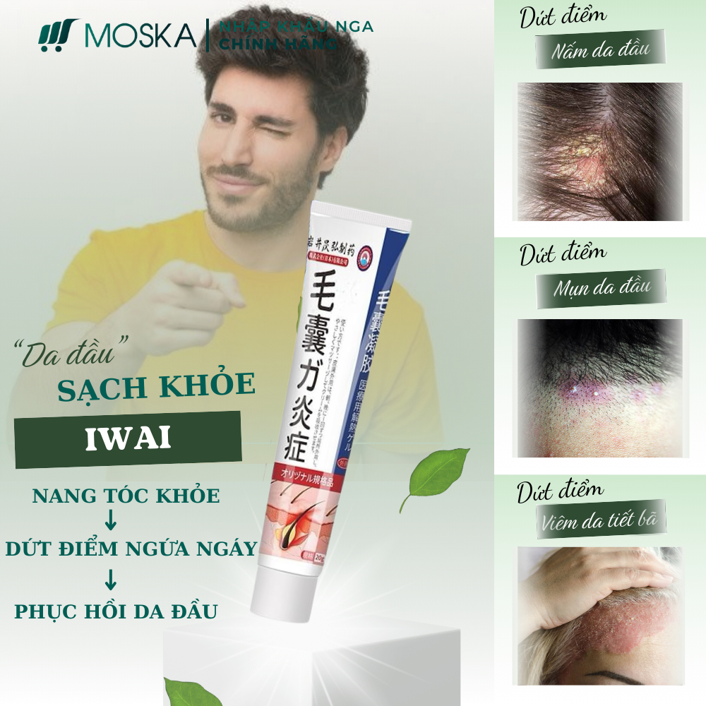 Kem viêm nấm ngứa da đầu, viêm nang tiết bã, viêm nang tóc, viêm nang lông IWAI, Sạch Nấm, Mụn Viêm Ngứa sau 7 ngày