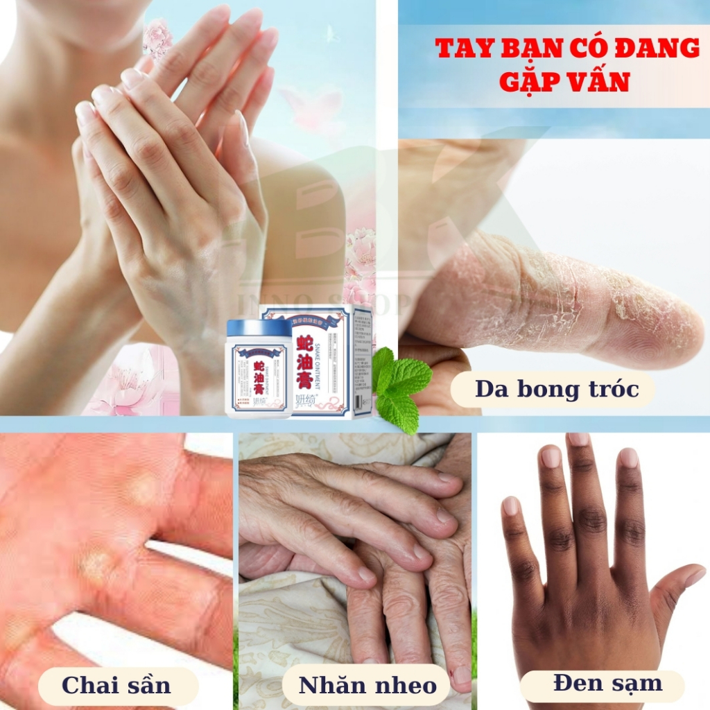 Kem Dưỡng Da Tay Đông Y GOLDEN SNAKE 50g – Dưỡng Ẩm Sâu, Mờ Nếp Nhăn, Chai Sần, Tăng Độ Đàn Hồi, Bảo Vệ Da Tay | BK INNO