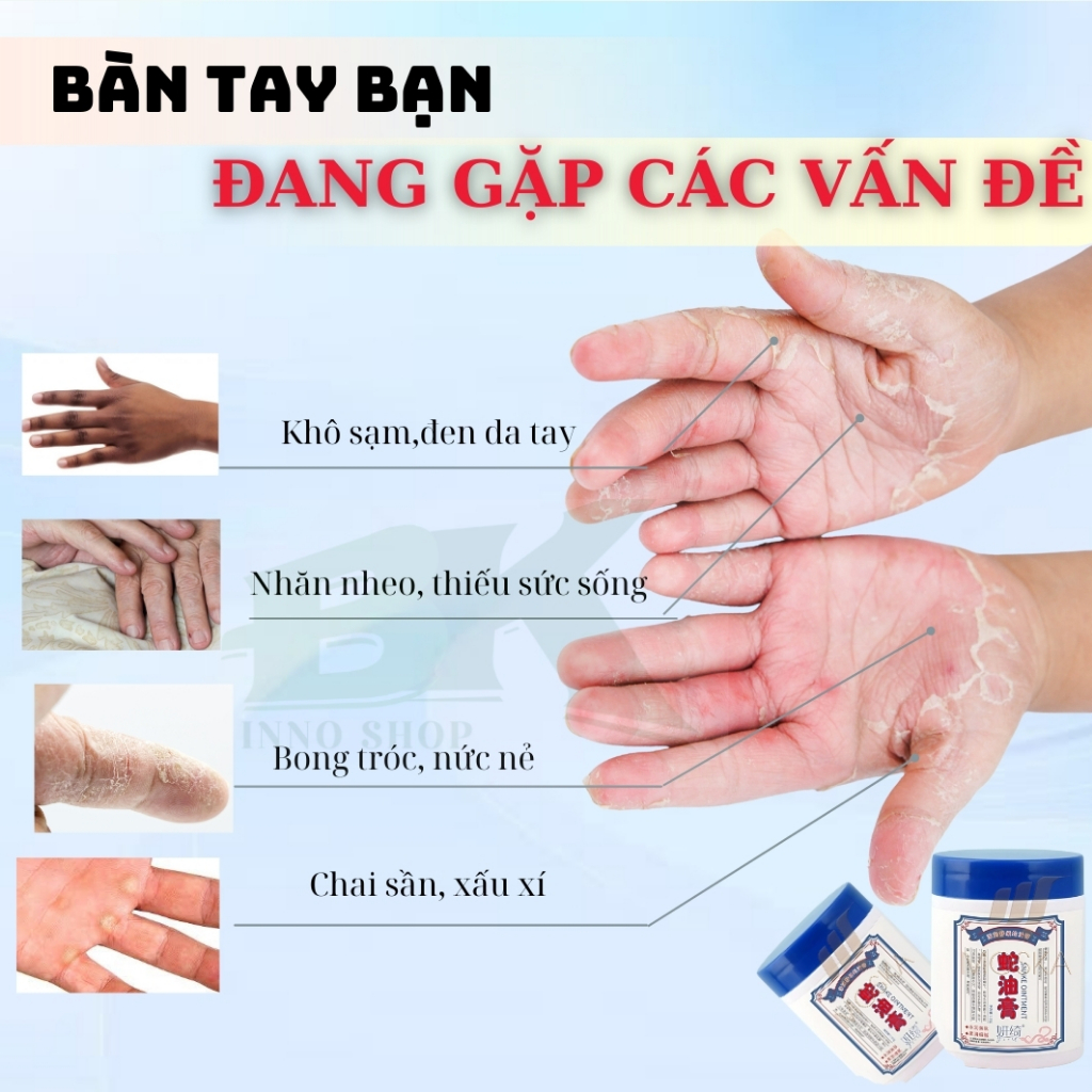 Kem Dưỡng Da Tay Đông Y GOLDEN SNAKE 50g – Dưỡng Ẩm Sâu, Trắng Mịn, Mờ Nếp Nhăn, Xoá Vết Chai Sần, Ngừa Lão Hóa | BK INN