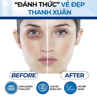 Thanh Lăn Giảm Thâm Quầng Mắt, Xóa Bọng Mắt Compliment Eye 11ml