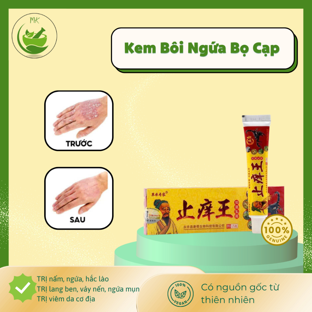 Kem bọ cạp bôi nấm ngứa, tổ đỉa, hắc lào, á sừng, Kem bôi bọ cạp vàng vua các loại nấm ngứa hắc lào