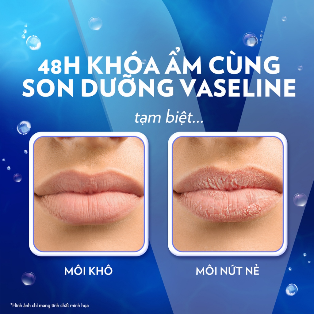 Son Dưỡng Môi Mềm Mịn Vaseline, Chiết Xuất Bơ Cacao, Lô Hội, Hồng Xinh 4.8g Hasaki Sản phẩm chính hãng
