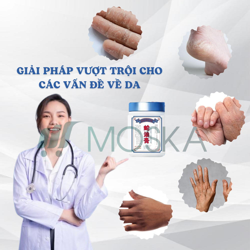 KEM DƯỠNG ẨM DA TAY BONG TRÓC XOÁ NHĂN ĐÔNG Y GOLDEN SNAKE 110GR, KEM DƯỠNG DA TAY CHÂN MỀM MỊN TRẮNG MƯỚT | Moska Shop