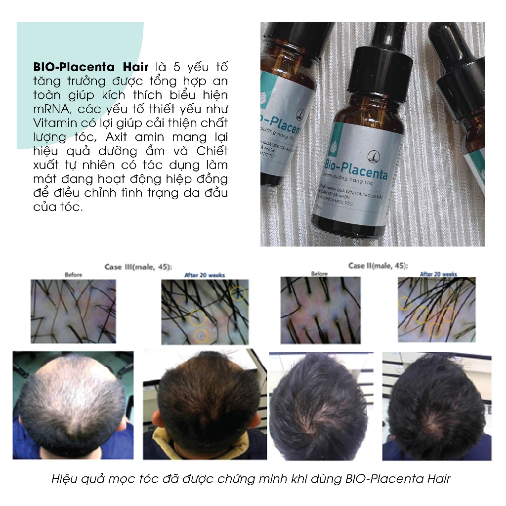 Serum dưỡng nang tóc Bio-Placental giúp phục hồi, nuôi dưỡng nang tóc và da đầu 30ml | BigBuy360 - bigbuy360.vn