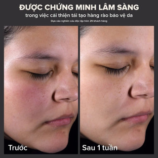 Dung dịch loại bỏ tế bào chết Paula's Choice 2% BHA 30ml (2)