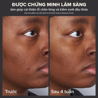 Dung dịch loại bỏ tế bào chết Paula's Choice 2% BHA 30ml (2)