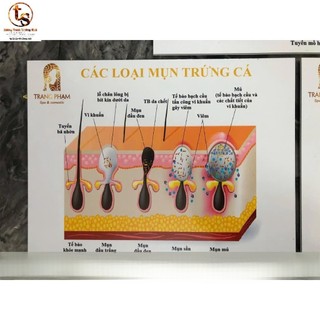 BỘ 3 TRANH CẤU TRÚC DA, Tranh Fomex dán tường 40x50cm Spa chăm sóc da mụn, tặng kèm băng dính