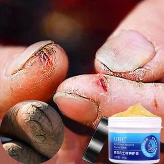  Vaseline Lotion Giảm Chân Nứt Chân Bàn Chân Khô Chăm Sóc Gót Chân Da Tay Bàn Chân Sừng   Kem dưỡng da chân 40g 