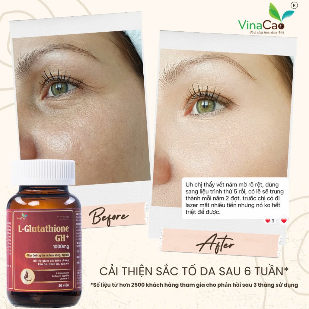 (Da' tốt hơn mua lẻ) Combo trắng da 2 loại Glutathione Vinacao 1000mg và 600mg làm trắng da, chống l