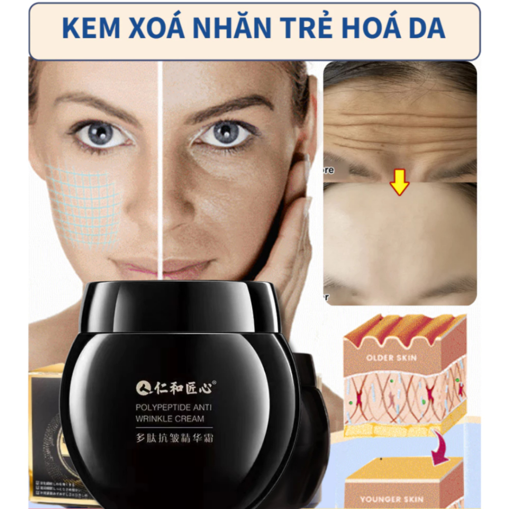 Kem dưỡng ẩm xóa nhăn Renhe - Kem Renhe chống lão hóa da, tái tạo xóa nhăn cho làn da căng mịn như tuổi đôi mươi - QUINN