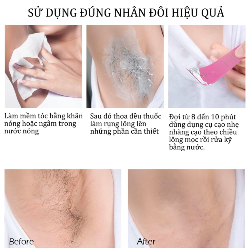 Kem tẩy lông SADOER - Kem triệt lông an toàn hiệu quả tại nhà, tẩy lông nách, tay, chân không đau 150ml