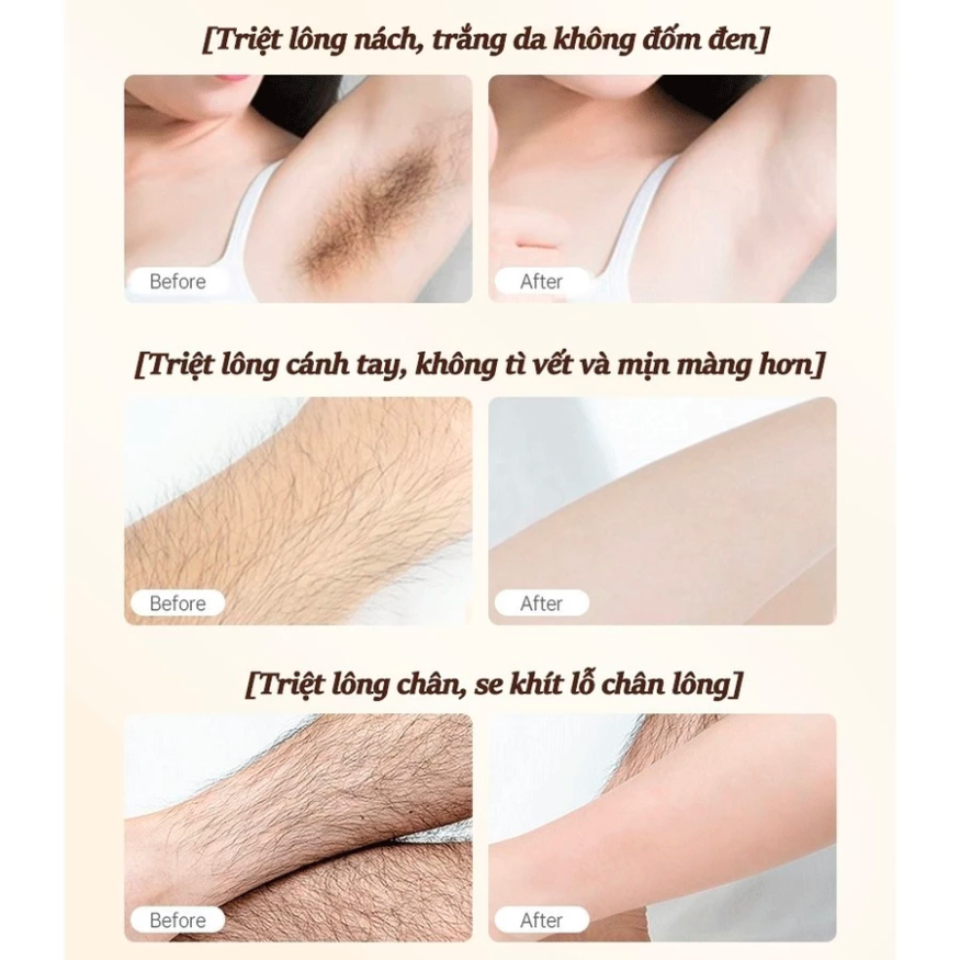 Kem tẩy lông SADOER - Kem triệt lông an toàn hiệu quả tại nhà, tẩy lông nách, tay, chân không đau 150ml