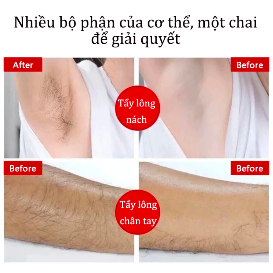 Kem tẩy lông SADOER - Kem triệt lông an toàn hiệu quả tại nhà, tẩy lông nách, tay, chân không đau 150ml