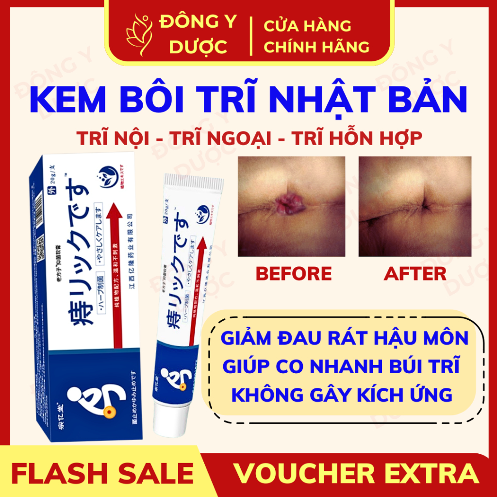 Kem Bôi Hỗ Trợ Trĩ Nội Trĩ Ngoại Giảm Khó Chịu Hậu Môn NHẬT BẢN Làm Dịu, Làm…