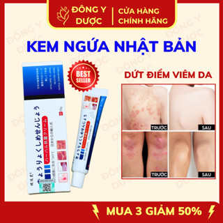   CHÍNH HÃNG  Kem Bôi Viêm Da Cơ Địa NHẬT BẢN Kem Bôi Nấm Ngứa Hỗ Trợ Dứt Điểm Hắc Lào Tổ Đỉa Á Sừng 