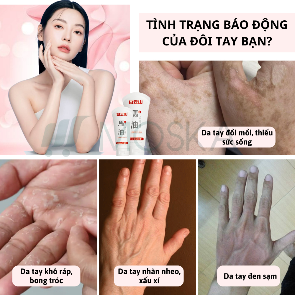 Kem Dưỡng Da Tay Bong Tróc HANJILIAN 80G - Xóa Nhăn, Giảm Nám, Ngăn Ngừa Đồi Mồi, Dưỡng Ẩm Sâu, Da Tay Trắng Sáng | MOSK