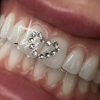 Đá đính răng hộp chân bằng và chân nhọn có tặng kèm keo và bút 10v/ 1 hộp