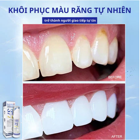 Kem Đánh Răng Trắng Răng DR.SUMI 377 - Kem đánh răng 377 Chăm Sóc Răng Miệng Hiệu Quả, Ngừa Sâu Răng Và Hôi Miệng