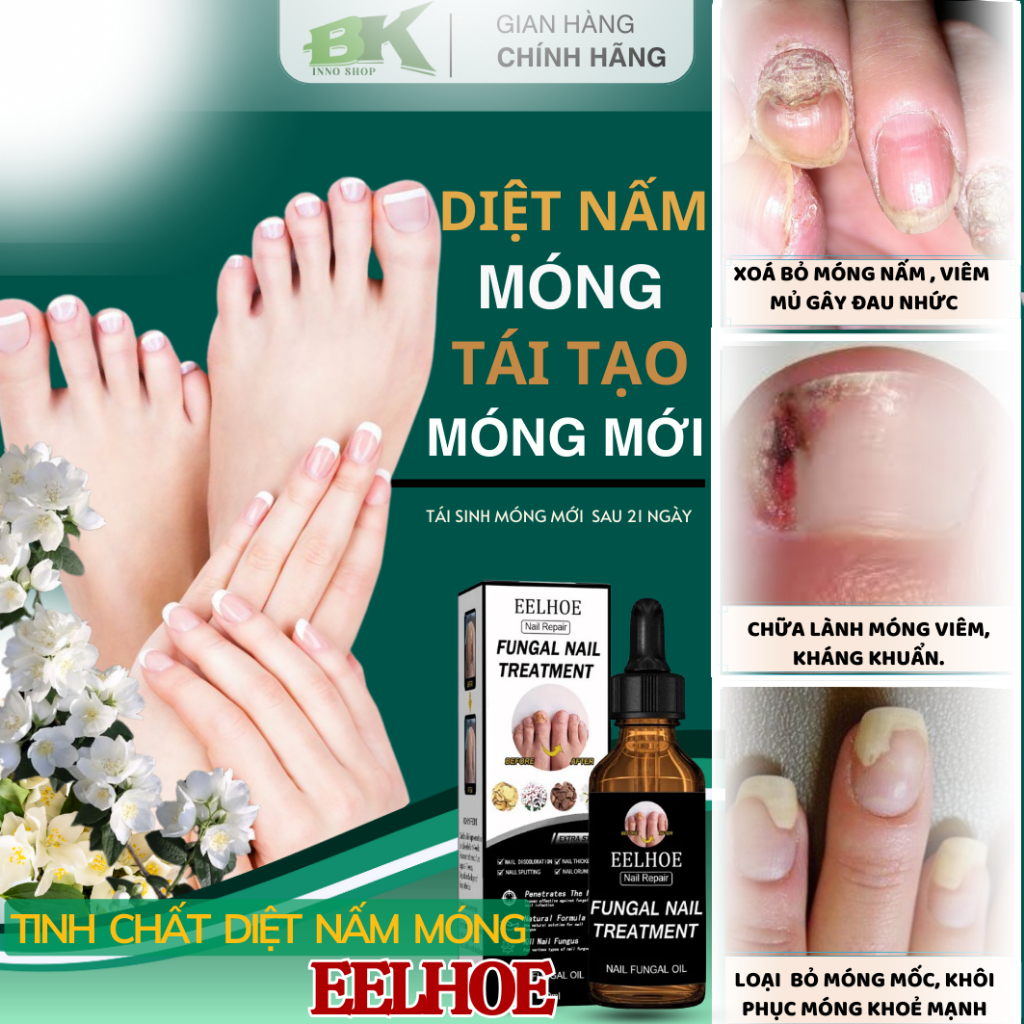 Tinh Chất Diệt Nấm Móng Thảo Dược EELHOE Mỹ 30ml Loại Bỏ Nấm Móng Tay Chân, Thối Móng Dưỡng Móng Cứng Chắc Khỏe| BK INNO