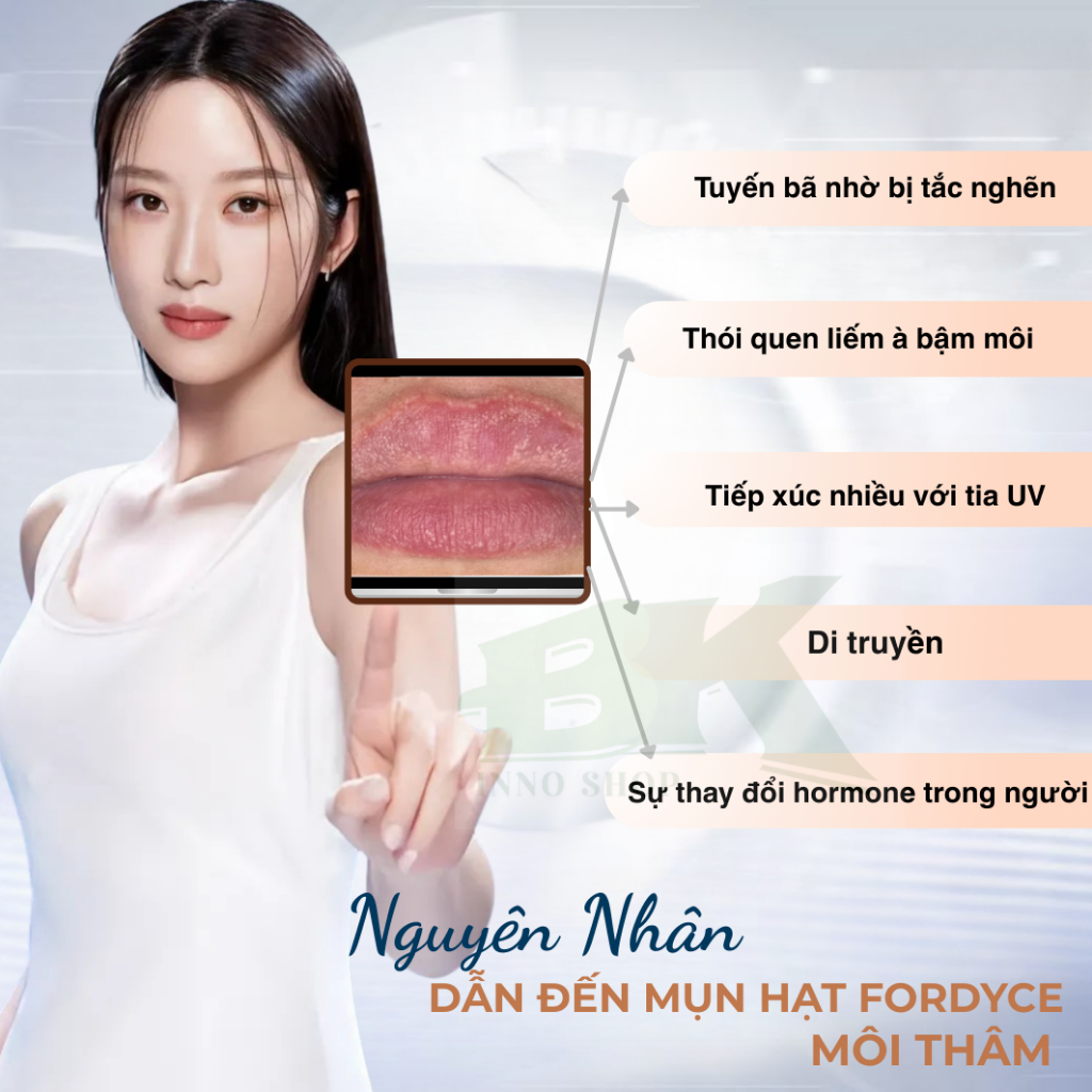 Kem Dưỡng Môi SUMIFUN 20g Loại Bỏ Hạt Fordyce, Giảm Mụn Bã Nhờn, Dưỡng Ẩm, Mờ Thâm Tái, Tạo Phục Hồi Môi Hồng Hào|BKINNO