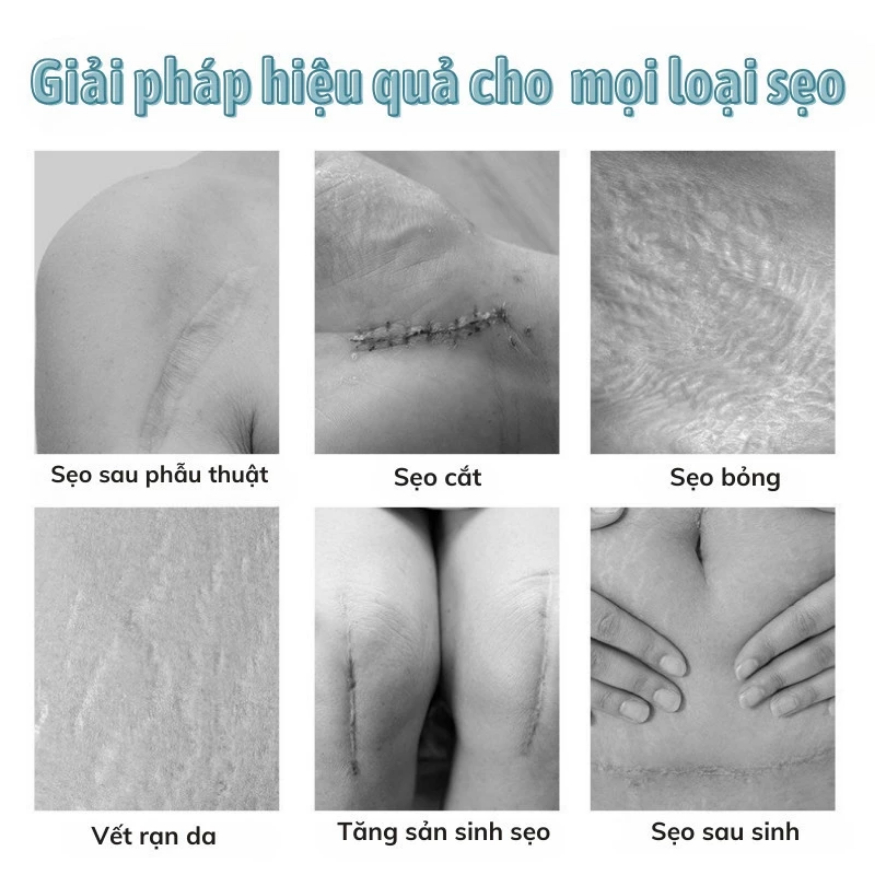 Gel mờ sẹo giảm thâm SCAR DISAPPEARS - Làm Mờ Sẹo Thâm, Sẹo Lồi Sẹo Mổ ,Hỗ Trợ Giảm Sẹo Thâm Giúp Da Mềm Mịn