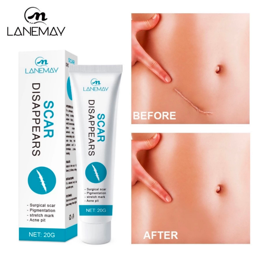Gel mờ sẹo giảm thâm SCAR DISAPPEARS - Làm Mờ Sẹo Thâm, Sẹo Lồi Sẹo Mổ ,Hỗ Trợ Giảm Sẹo Thâm Giúp Da Mềm Mịn