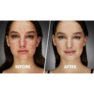 Tinh Chất Skinceuticals Retexturing Activator Serum