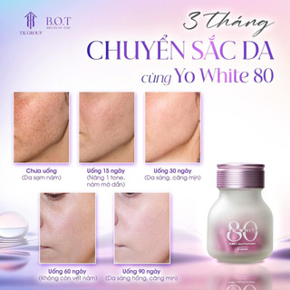 Viên Uống Trắng Da Yo White 80, Viên Trắng Da Chống Nắng Nội Sinh Yo White 80 GeniShop Giúp Da Trắng Sáng Dưỡng Da