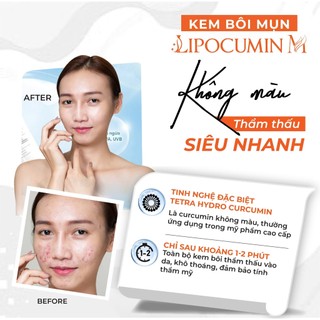 Kem chấm mụn, mờ thâm sẹo - LIPOCUMIN M. Hiệu quả sau 3-5 ngày