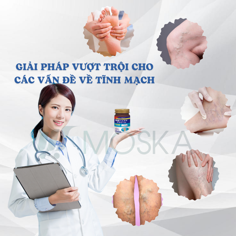 KEM BÔI SUY GIÃN TĨNH MẠCH SENJOKO NHẬT BẢN 50G - GIẢM GIÃN TĨNH MẠCH, CẢI THIỆN ĐAU NHỨC SƯNG TẤY CHÂN HIỆU QUẢ | MOSKA