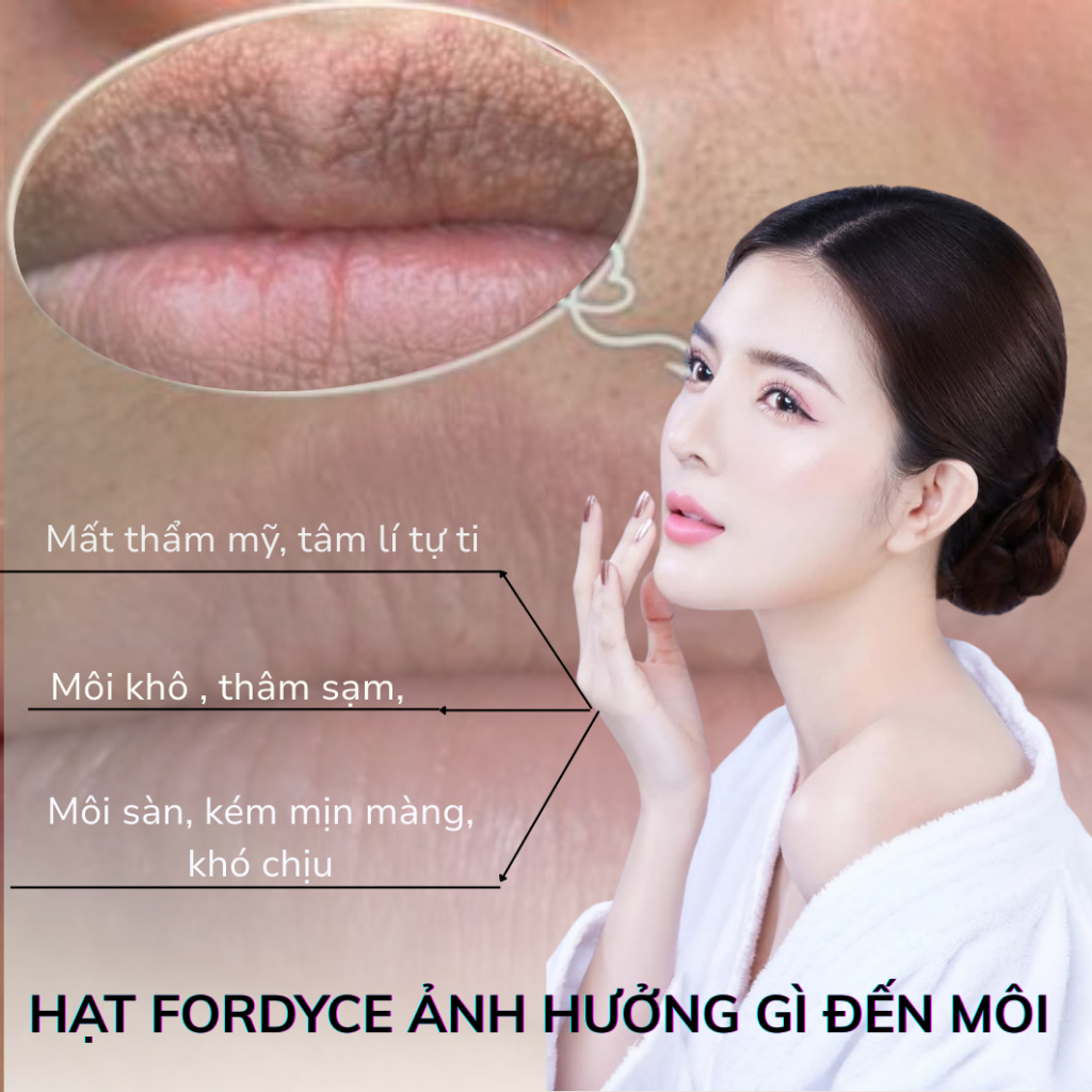 Kem Dưỡng Môi SUMIFUN 20g - Xoá Sạch Hạt Fordyce, Giảm Mụn Bã Nhờn, Cấp Ẩm, Tái Tạo Phục Hồi Đôi Môi Hồng Hào | BKINNO