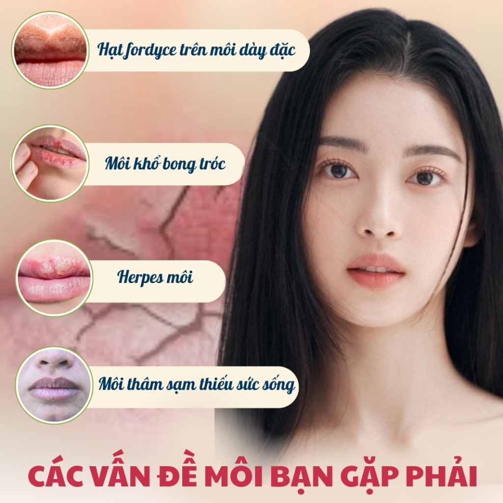 Kem Dưỡng Môi SUMIFUN 20g - Xoá Sạch Hạt Fordyce, Giảm Mụn Bã Nhờn, Cấp Ẩm, Tái Tạo Phục Hồi Đôi Môi Hồng Hào | BKINNO