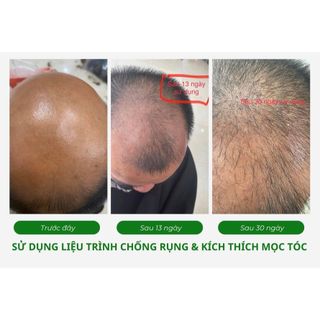 Xịt mọc tóc Cehko Haartonikum 75ml-250ml
