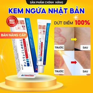 Kem Bôi Viêm Da Cơ Địa NHẬT BẢN Hỗ Trợ Dứt Điểm Lác Đồng Tiền, Nấm Da Đầu, Ghẻ Nước, Á Sừng Cực Kì Hiệu Quả