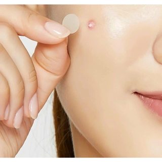Dán Mụn Cosrx Acne Pimple Master Patch