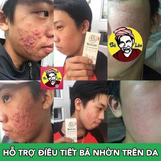 [MUA 1 TẶNG 3] Serum Mụn Thâm Sẹo Cao Cấp Bà Lão Dành Cho Mọi Loại Da Kèm Mặt Nạ Dưỡng