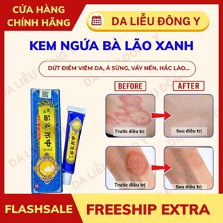 [Chính Hãng] Kem Bôi Nấm Ngứa Da BÀ LÃO XANH Thảo Dược Hỗ Trợ Dứt điểm Hắc Lào Nấm Ngứa Á Sừng Lang Ben Vẩy Nến