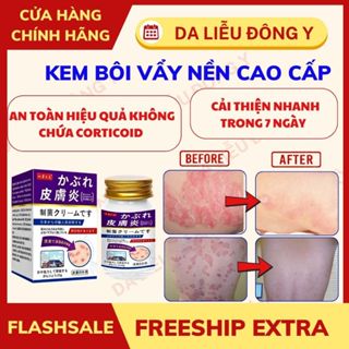[Chính Hãng] Kem Bôi Da Liễu Nakusa Nấm Hắc Lào Vẩy Nến Á Sừng Tổ Đỉa diện rộng 55g Nguyên Liệu Nhập khẩu Nhật