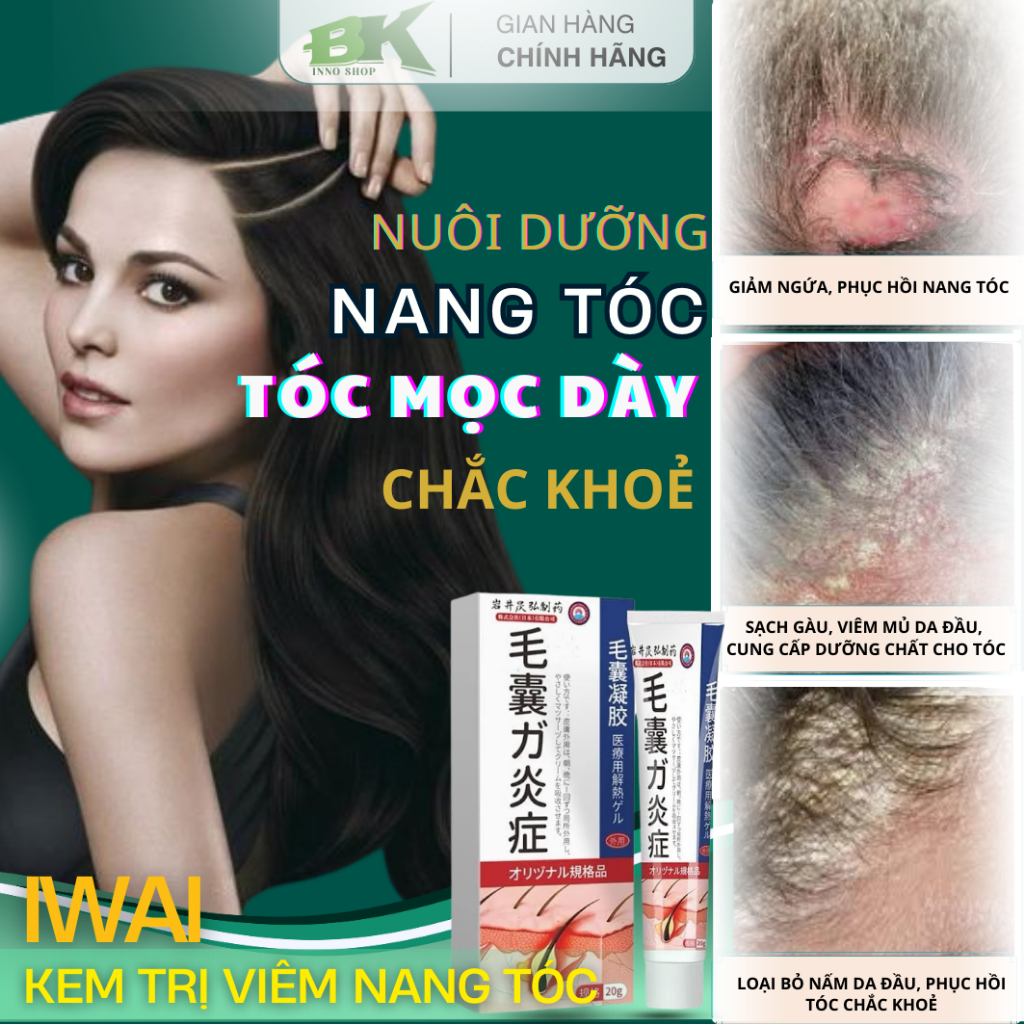 Kem Bôi Viêm Nang Lông Tóc IWAI Phục Hồi Da Đầu, Giảm Viêm, Kháng Khuẩn, Phục Hồi Nang Tóc, Giúp Tóc Chắc Khoẻ | BK INNO
