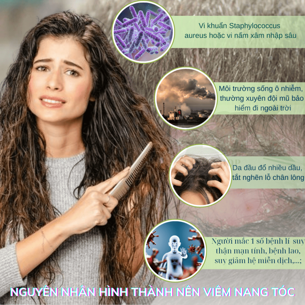 Kem Bôi Viêm Nang Lông Tóc IWAI Phục Hồi Da Đầu, Giảm Viêm, Kháng Khuẩn, Phục Hồi Nang Tóc, Giúp Tóc Chắc Khoẻ | BK INNO