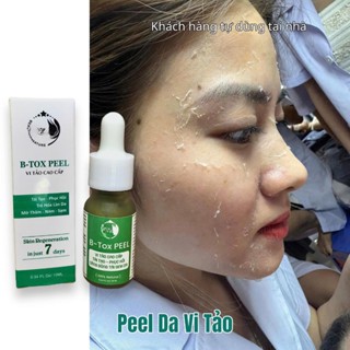(10ml) B-TOX Peel Da Mặt Vi Tảo Cao Cấp - ( tẩy da chết - giảm mụn mờ nám tàn nhang - peel lột da mặt retinol yubi80 )