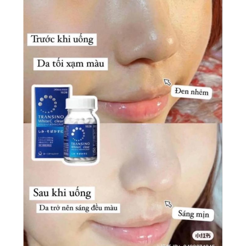 Viên uống TRẮNG DA MỜ THÂM NÁM Transino White C Clear 120 viên Nhật Bản