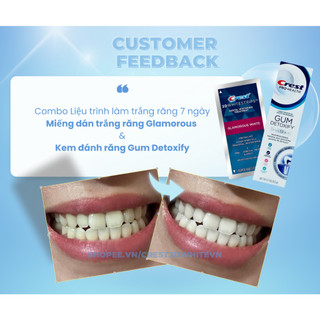 Miếng dán trắng răng Crest Combo 5 ngày