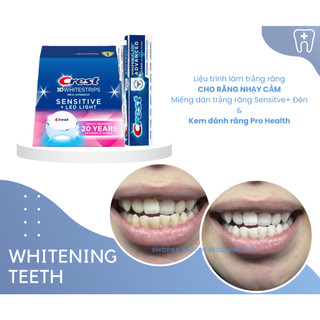 Miếng dán trắng răng Crest Combo 5 ngày