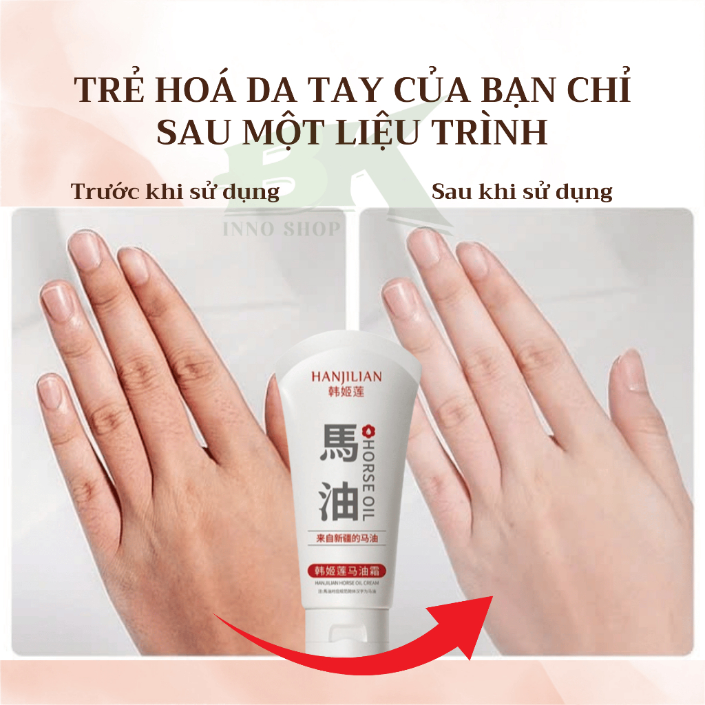 KEM DƯỠNG TRẮNG DA TAY CHÂN CAO CẤP HANJILIAN 80GR, KEM XOÁ NHĂN DA TAY BONG TRÓC, CHO ĐÔI TAY TRẮNG NUỘT, MỊN MÀNG |BK
