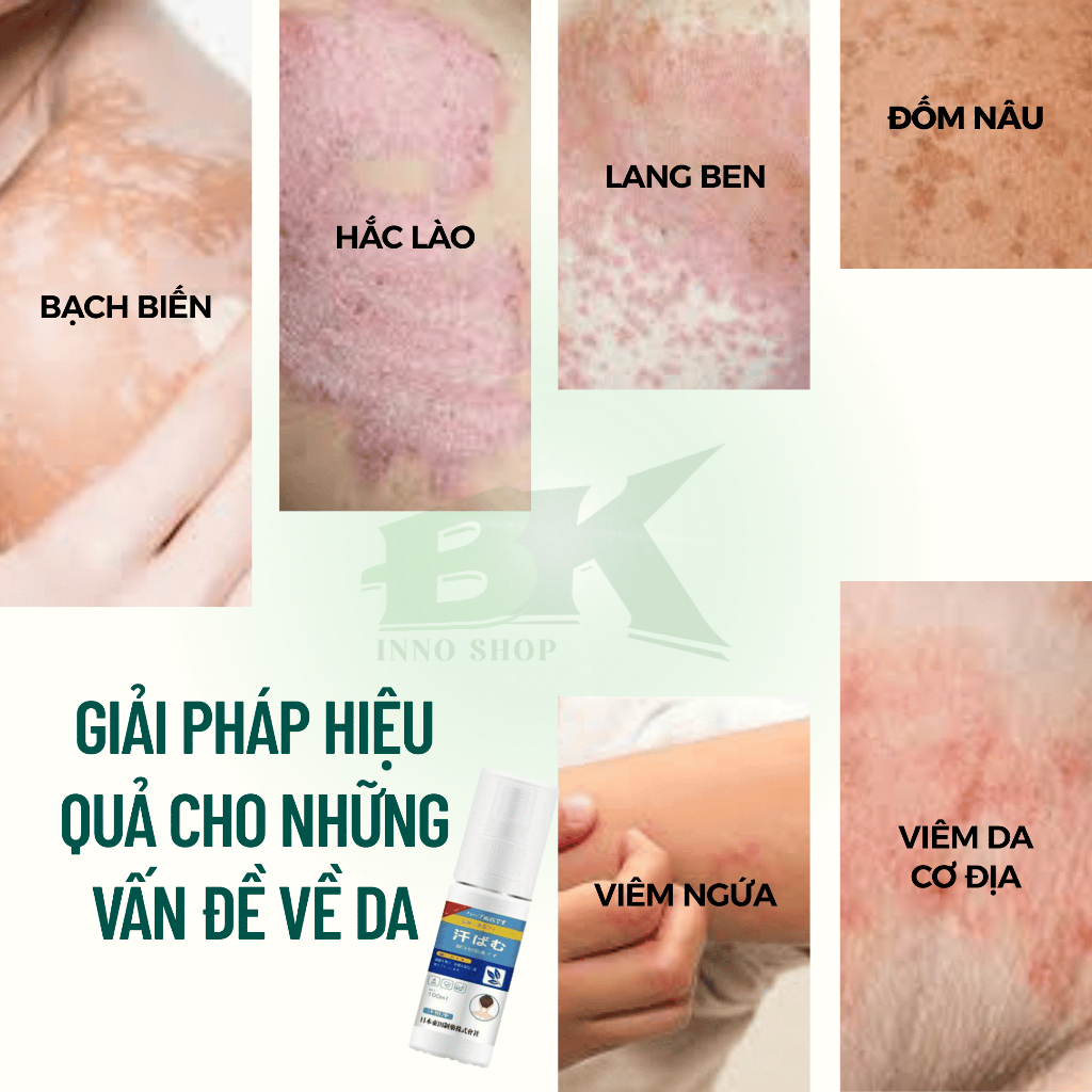 Xịt Bạch Biến Thảo Dược SENKO Nhật Bản 100ml Xoá Mờ Bạch Biến, Hắc Lào, Lang Ben, Vẩy Phấn Trắng, Da Đốm Trắng | BK INNO