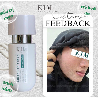 TINH CHẤT VIP mới